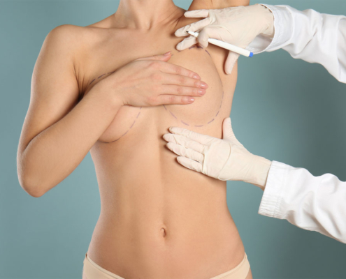 breast augmentation surgery cost 2022